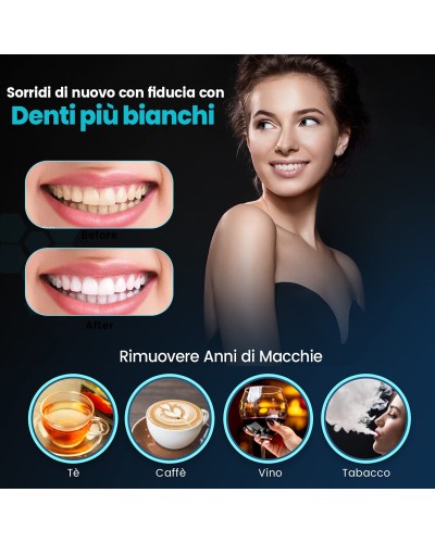 Mysmile Led Light Teeth Whitening Kit plus 6x3ml Aktivkohle-Gel, beste professionelle Zahnaufhellung Mysmile Led Light Teeth Whitening Kit plus 6x3ml Aktivkohle-Gel, beste professionelle Zahnaufhellung
